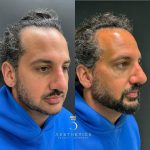 acff480a-a126-4449-b72d-ae5ecb68c086(1)-min