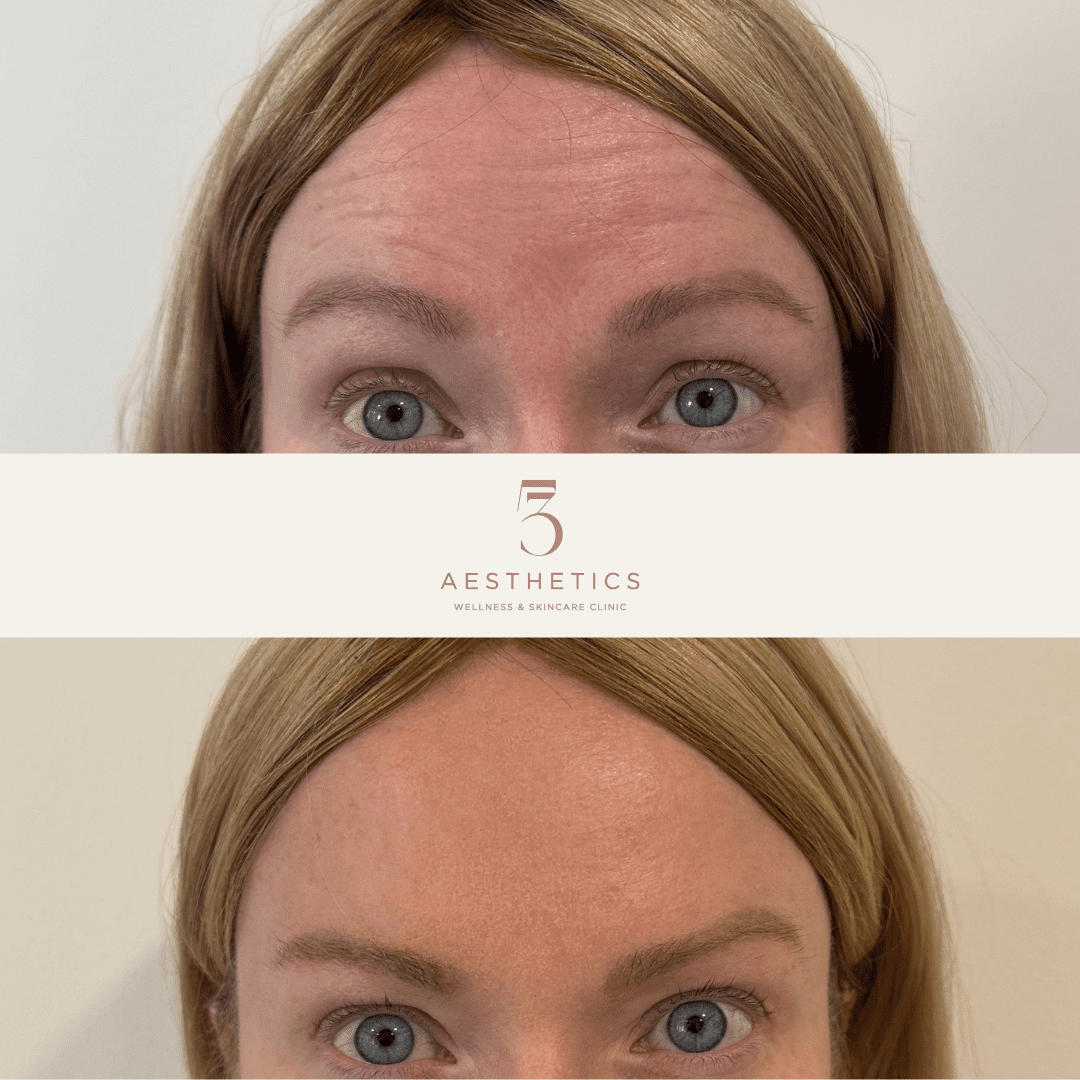 before and after's instagram static posts layout (23)