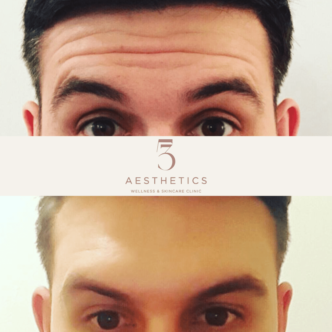 before and after's instagram static posts layout (24)