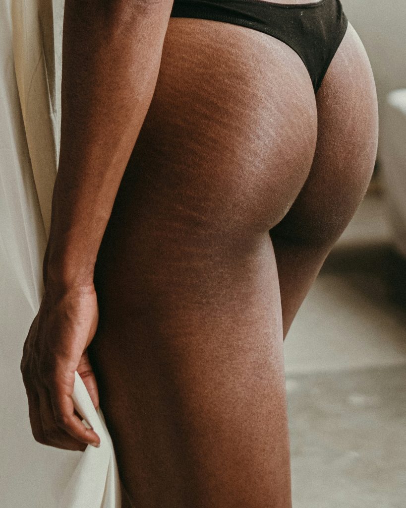lower body of a woman from behind in black underwear with stretchmarks